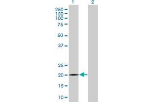 Western Blot analysis of SPANXB1 expression in transfected 293T cell line by SPANXB1 MaxPab polyclonal antibody. (SPANXB1 anticorps  (AA 1-103))
