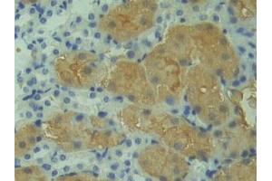 Detection of HMGCS in Mouse Kidney Tissue using Polyclonal Antibody to Hydroxymethylglutaryl Coenzyme A Synthase (HMGCS)
