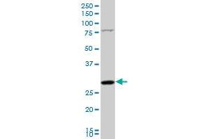 NUDT5 polyclonal antibody (A01), Lot # 060102JC01 Western Blot analysis of NUDT5 expression in Jurkat .