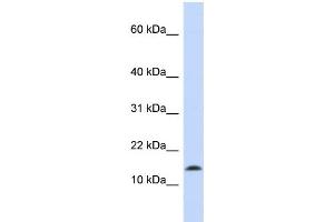 WB Suggested Anti-SNCA Antibody Titration:  0. (SNCA anticorps  (Middle Region))