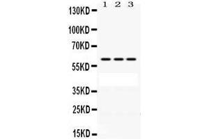 Western Blotting (WB) image for anti-Protection of Telomeres 1 (POT1) (AA 195-234), (N-Term) antibody (ABIN3043444) (POT1 anticorps  (N-Term))