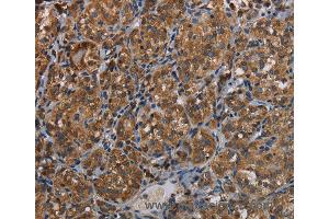 Immunohistochemistry of Human brain  using LLGL1 Polyclonal Antibody at dilution of 1:40 (LLGL1 anticorps)