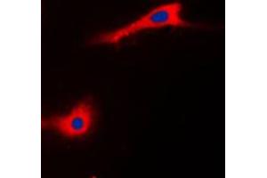 Immunofluorescent analysis of CABC1 staining in HeLa cells.