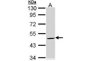 WB Image Sample (30 ug of whole cell lysate) A: Hela 10% SDS PAGE antibody diluted at 1:3000 (KRT20 anticorps)