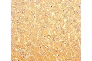 Immunohistochemistry of paraffin-embedded human liver tissue using ABIN7166656 at dilution of 1:100 (LPAL2 anticorps  (AA 52-124))