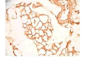 Mouse visceral fat tissue was stained by Rabbit Anti-SFRP-2 S (25-50) (Human) Antiserum (SFRP2 anticorps  (AA 25-50))