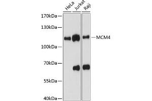 Western blot analysis of extracts of various cell lines, using MCM4 antibody (ABIN6134153, ABIN6143642, ABIN6143643 and ABIN6217540) at 1:1000 dilution. (MCM4 anticorps  (AA 350-450))