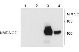 Image no. 1 for anti-NMDA Receptor 1 (NMDA R1) (Splice Variant C2') antibody (ABIN372677) (NMDA 1 Receptor anticorps  (Splice Variant C2'))