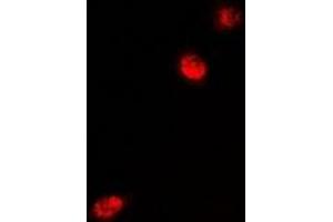 Immunofluorescent analysis of MeCP2 staining in U2OS cells.