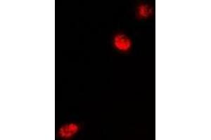 Immunofluorescent analysis of MeCP2 staining in U2OS cells. (MECP2 anticorps)
