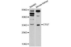 Western blot analysis of extracts of various cell lines, using CTGF antibody (ABIN5997530) at 1/1000 dilution. (CTGF anticorps)