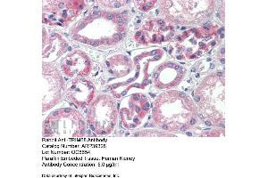 Immunohistochemistry with Human kidney lysate tissue at an antibody concentration of 5. (TRIM68 anticorps  (Middle Region))
