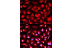 Immunofluorescence analysis of U2OS cells using ETS1 antibody (ABIN6293299). (ETS1 anticorps)