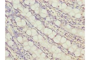Immunohistochemistry of paraffin-embedded human colon tissue using ABIN7166380 at dilution of 1:100 (ZNF767P anticorps  (AA 1-118))
