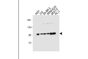 All lanes : Anti-ADTS17 Antibody (Center) at 1:500 dilution Lane 1: A431 whole cell lysate Lane 2: 293 whole cell lysate Lane 3: SK-BR-3 whole cell lysate Lane 4: RI 8226 whole cell lysate Lane 5: MOLT-4 whole cell lysate Lane 6: PC-3 whole cell lysate Lysates/proteins at 20 μg per lane.