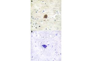 Immunohistochemical staining (Formalin-fixed paraffin-embedded sections) of human brain tissue with CAMK2A/CAMK2B/CAMK2D (phospho T305) polyclonal antibody  without blocking peptide (A) or preincubated with blocking peptide (B) under 1:50-1:100 dilution. (CAMK2A anticorps  (pThr305))