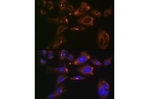 Immunofluorescence analysis of U-2 OS cells using ACLY Rabbit mAb (ABIN1678575, ABIN7101559, ABIN7101560 and ABIN7101561) at dilution of 1:100 (40x lens). (ACLY anticorps)