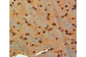 IHC-P analysis of brain tissue, with DAB staining. (GAD anticorps  (AA 1-97))