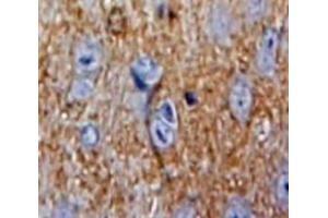 Used in DAB staining on fromalin fixed paraffin-embedded Brain tissue