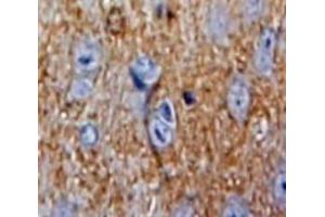 Used in DAB staining on fromalin fixed paraffin-embedded Brain tissue (SOD4 anticorps  (AA 17-270))