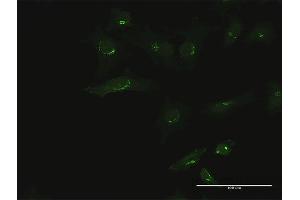 Immunofluorescence of purified MaxPab antibody to B3GALT6 on HeLa cell.