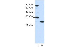 WB Suggested Anti-ANP32A  Antibody Titration: 0. (PHAP1 anticorps  (Middle Region))