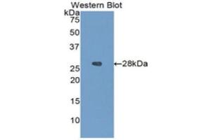 Western Blotting (WB) image for anti-Insulin-Like Growth Factor Binding Protein 4 (IGFBP4) (AA 22-258) antibody (ABIN3201236) (IGFBP4 anticorps  (AA 22-258))