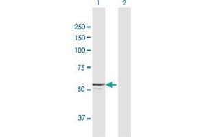 Western Blot analysis of CYP27A1 expression in transfected 293T cell line by CYP27A1 MaxPab polyclonal antibody.
