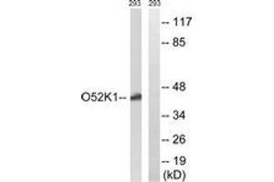 Western blot analysis of extracts from 293 cells, using OR52K1 Antibody. (OR52K1 anticorps  (AA 201-250))