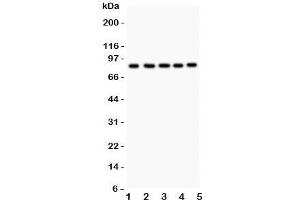 Western blot testing of FOXM1 antibody and Lane 1:  HeLa;  2: COLO320;  3: SW620;  4: SKOV;  5: MCD-7. (FOXM1 anticorps  (AA 411-763))