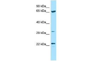 WB Suggested Anti-ICOSLG Antibody Titration: 1. (ICOSLG anticorps  (N-Term))