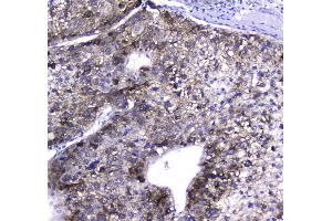 IHC analysis of HGD using anti-HGD antibody .