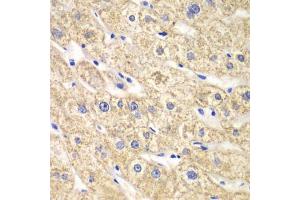 Immunohistochemistry of paraffin-embedded human liver injury using ACADS antibody (ABIN5970342) at dilution of 1/100 (40x lens). (ACADS anticorps)