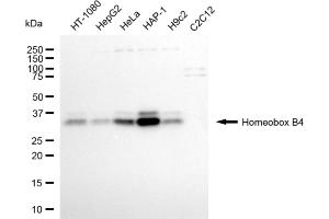 Western blotting analysis using homeobox B4 antibody (ABIN7798992). (Recombinant HOXB4 anticorps)