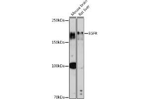 Western blot analysis of extracts of various cell lines, using EGFR antibody (ABIN7266982) at 1:1000 dilution.