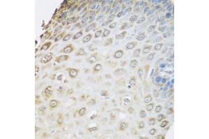 Immunohistochemistry of paraffin-embedded human esophagus using GRPEL2 antibody at dilution of 1:100 (40x lens). (GRPEL2 anticorps)