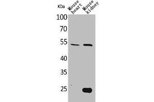 Western Blot analysis of mouse heart mouse kidney cells using Sg III Polyclonal Antibody (SCG3 anticorps  (N-Term))