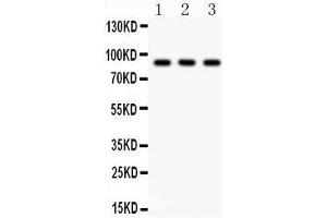 Anti-CTCF Picoband antibody, Western blotting All lanes: Anti CTCF  at 0. (CTCF anticorps  (AA 521-727))