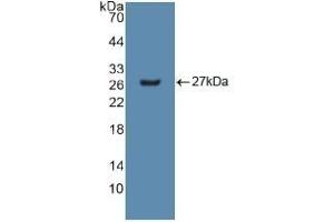 Detection of Recombinant GSTm2, Human using Polyclonal Antibody to Glutathione S Transferase Mu 2 (GSTM2) (GSTM2 anticorps  (AA 3-218))