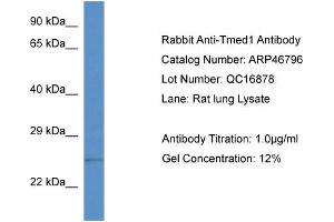 WB Suggested Anti-Tmed1 Antibody   Titration: 1. (TMED1 anticorps  (N-Term))