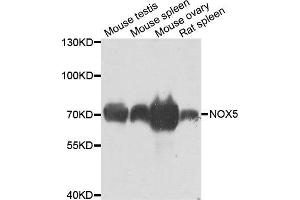Western blot analysis of extracts of various cell lines, using NOX5 antibody. (NOX5 anticorps)