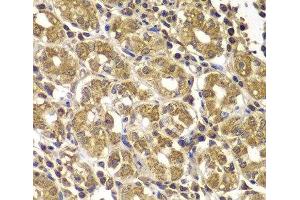 Immunohistochemistry of paraffin-embedded Human gastric using HSPE1 Polyclonal Antibody at dilution of 1:100 (40x lens). (HSPE1 anticorps)