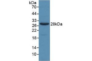 WB of Protein Standard: different control antibodies against Highly purified E. (alpha 2 Macroglobulin Kit CLIA)