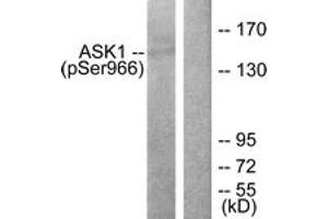 Western blot analysis of extracts from 293 cells treated with TNF(20ng/ml)+calyculinA(50nM) 15', using ASK1 (Phospho-Ser966) Antibody.