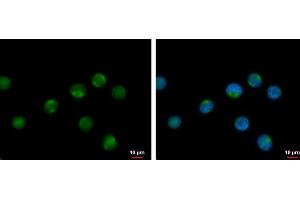 ICC/IF Image RPL17P7 antibody detects RPL17P7 protein at cytoplasm by immunofluorescent analysis. (RPL17P7 anticorps  (Center))