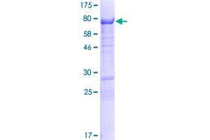 Image no. 1 for G Protein Regulated Inducer of Neurite Outgrowth 2 (GPRIN2) (AA 1-461) protein (GST tag) (ABIN1355653)