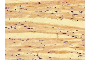 Immunohistochemistry of paraffin-embedded human heart tissue using ABIN7163828 at dilution of 1:100