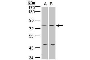 WB Image Sample(30 ug whole cell lysate) A:293T B:MOLT4 , 7.