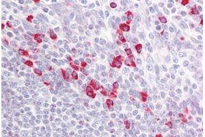 Anti-PAK1/2/3 antibody IHC staining of human tonsil. (PAK1/2/3 anticorps  (AA 391-440))