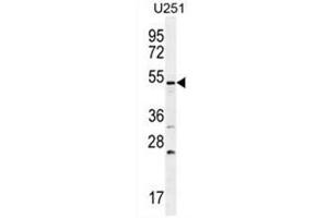 BMPR1B Antibody (Center) western blot analysis in U251 cell line lysates (35µg/lane).